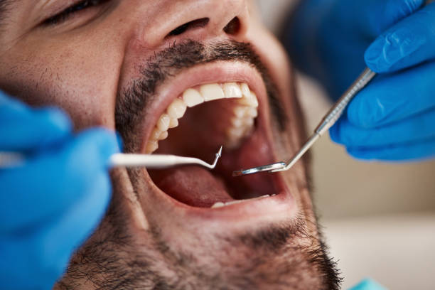 Best After-Hours Dental Trauma Care in Byng, OK